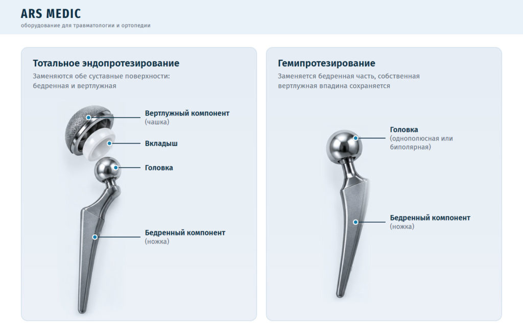 Тотальный эндопротез и гемипротез тазобедренного сустава: чашка, вкладыш, головка и ножка