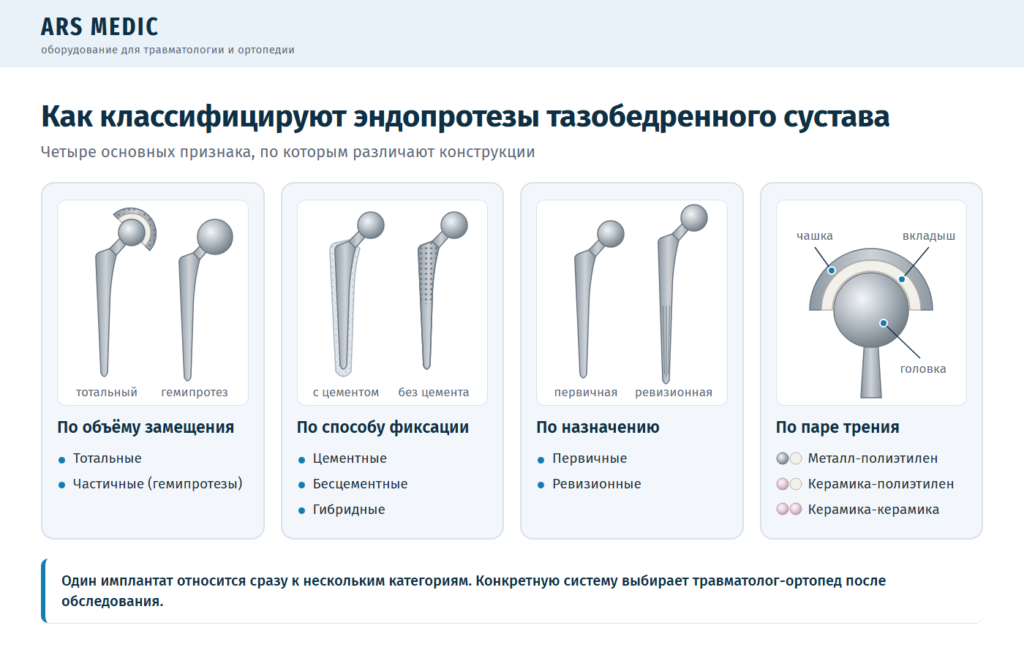 Схема классификации эндопротезов тазобедренного сустава по объёму, фиксации, назначению и паре трения