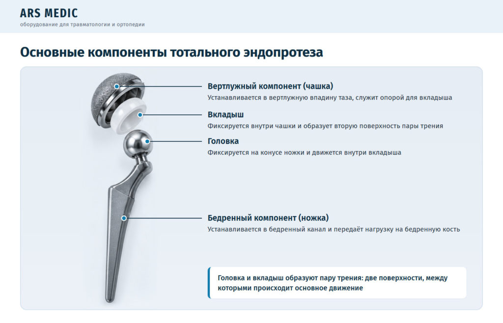 Компоненты тотального эндопротеза тазобедренного сустава с подписями: чашка, вкладыш, головка, ножка