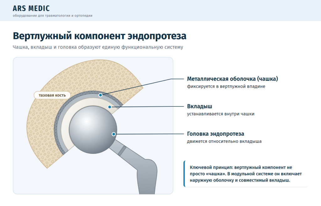 Схема вертлужного компонента в разрезе: металлическая чашка, вкладыш и головка эндопротеза