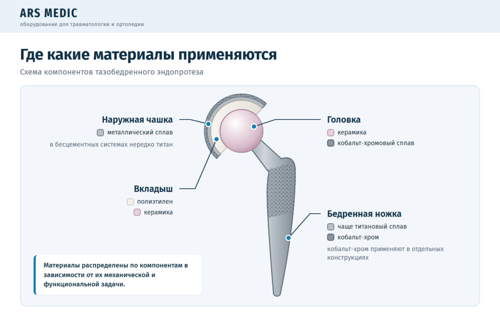 Схема эндопротеза тазобедренного сустава с материалами чашки, вкладыша, головки и бедренной ножки