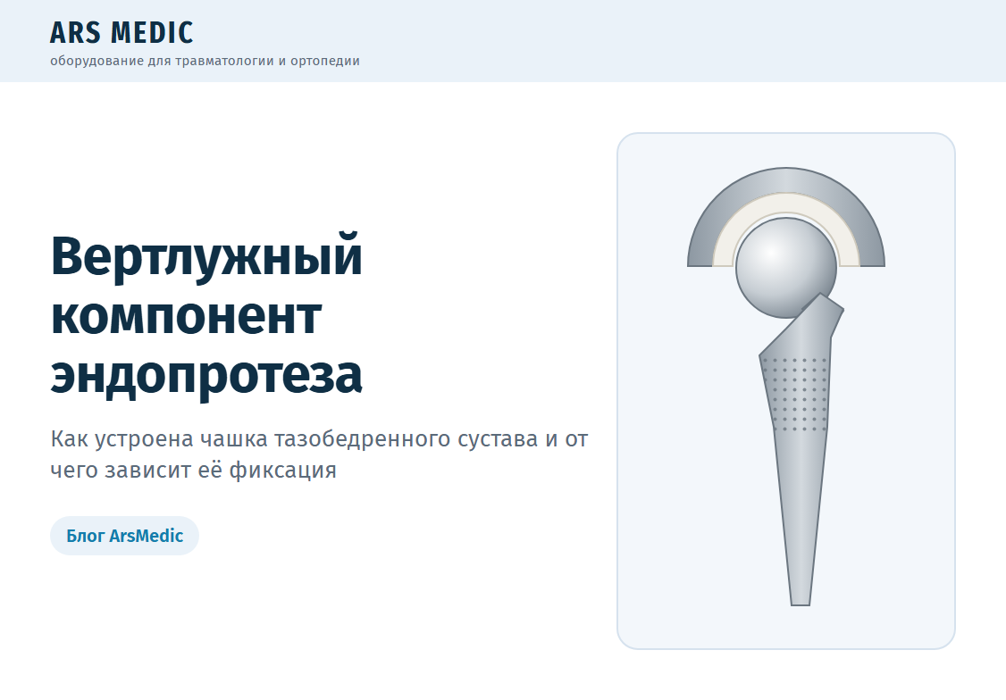 Вертлужный компонент эндопротеза: как устроена чашка тазобедренного сустава и от чего зависит её фиксация